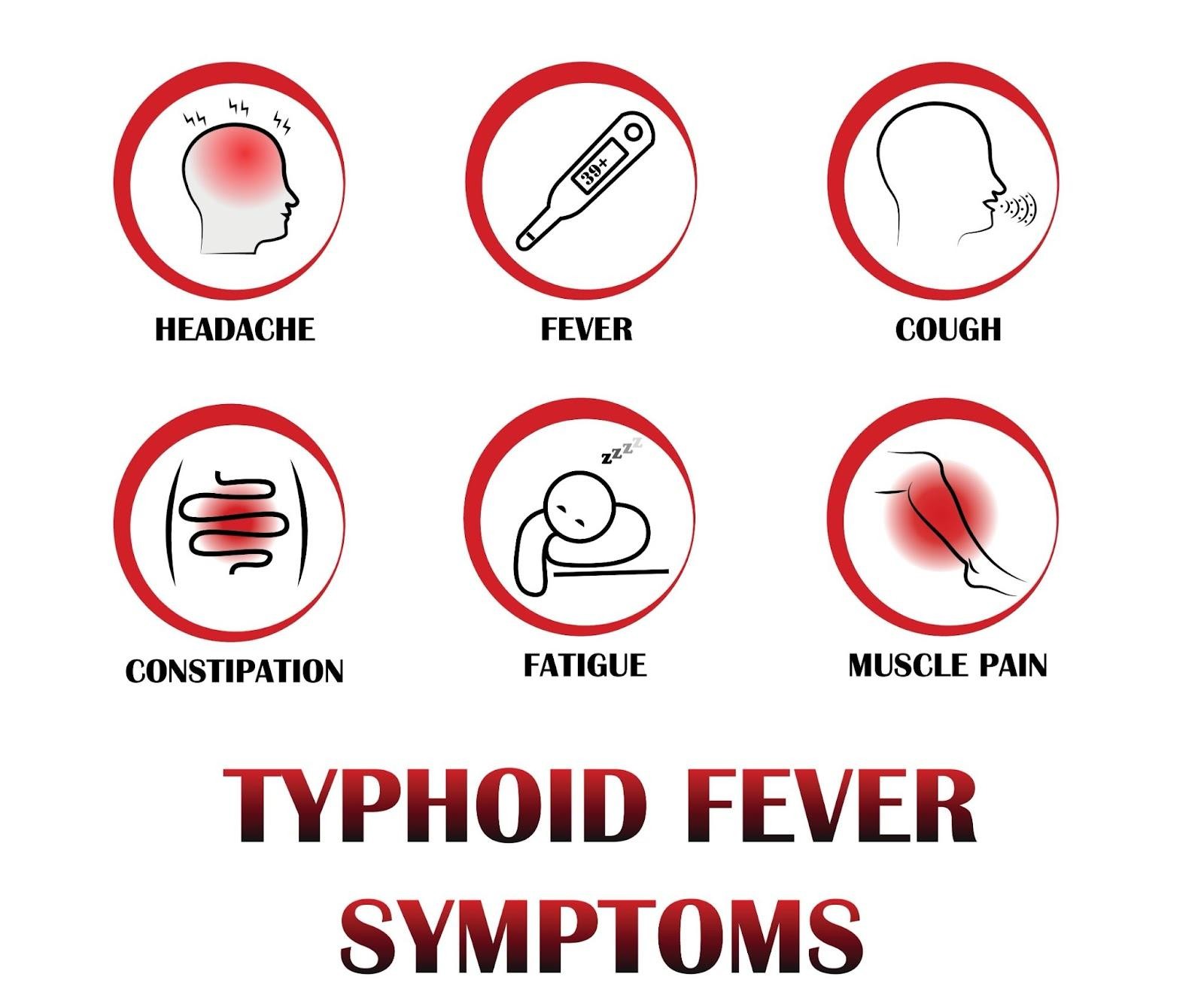 Typhoid Fever Symptoms Singapore