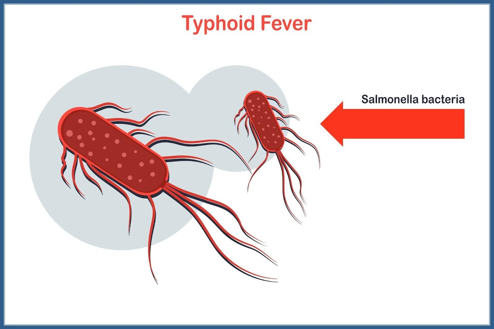 Typhoid Fever Singapore