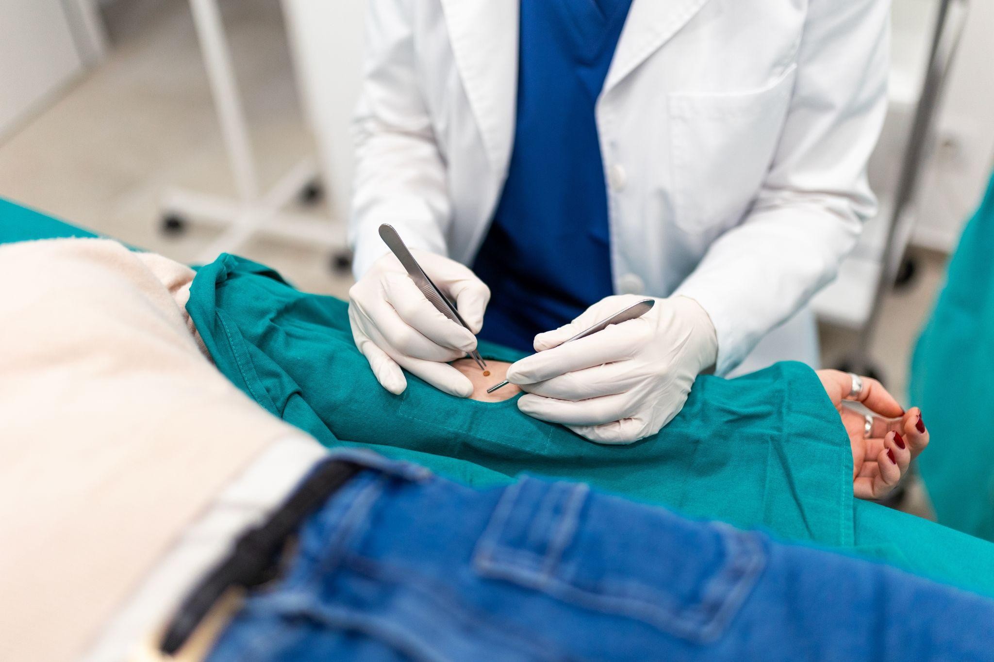 Minor Surgical Procedure Singapore